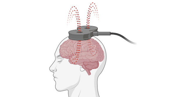 motor cortex image